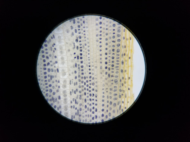 Onion Root Mitosis Slides - Onion Root  Mitosis  01 400X
